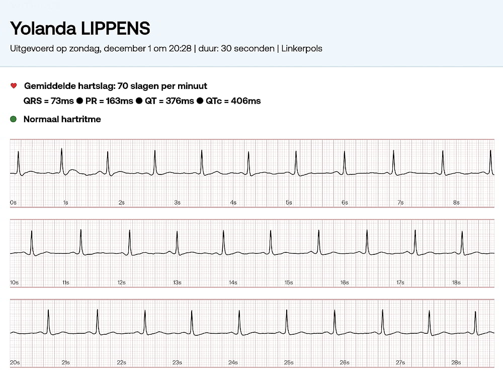 yolanda lippens loopt door ablatie